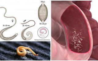 Как да премахнете червеи при възрастни и деца