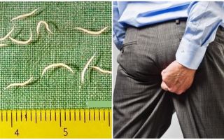 Симптоми и лечение на червеи при възрастни