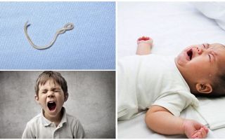 Симптоми и лечение на аскариаза при деца