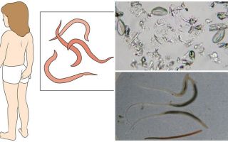 Какво представляват pinworms и как изглеждат те