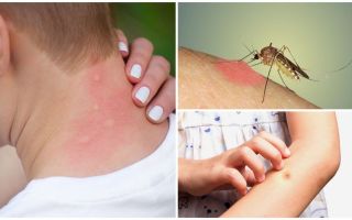 Защо комарите ухапват сърбежа