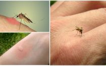 Защо комарите хапят някои хора повече от останалите