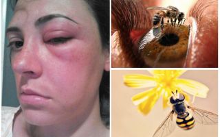 Какво ще стане, ако една пчела бие в очите и тя набъбна