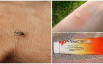 Как и как да премахнете сърбежа от ухапване от комари в дете и възрастен