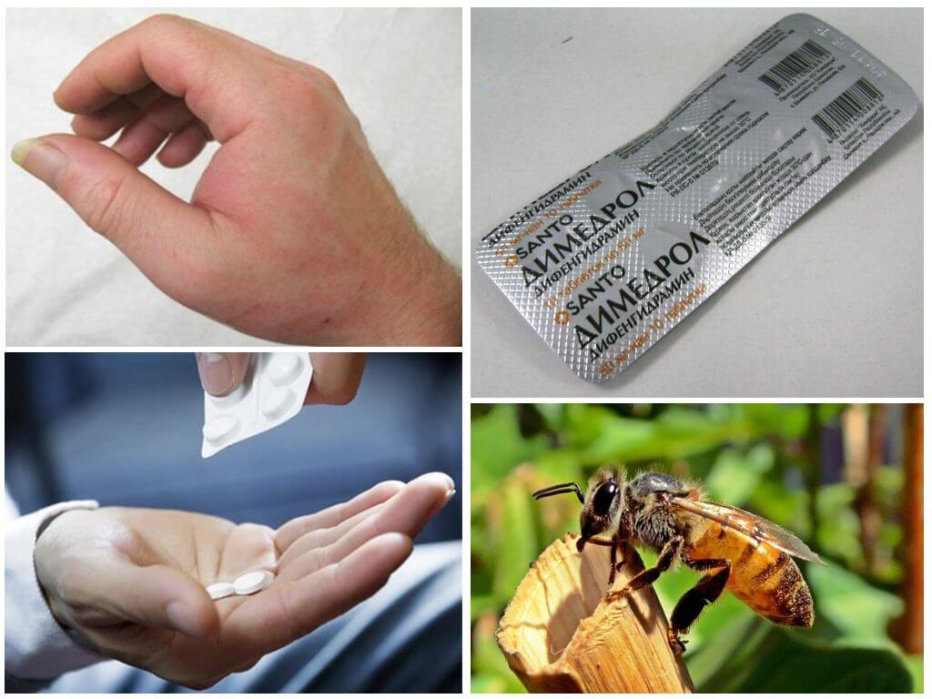 Алергия към хапчетата
