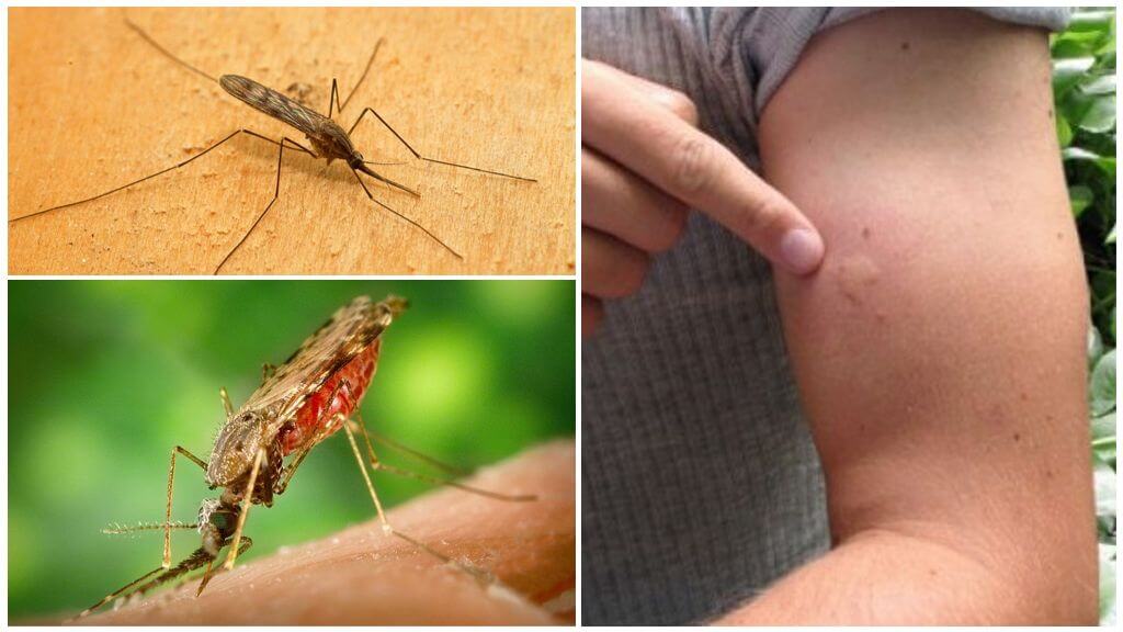 Комари за ухапване от комари