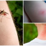 Захапка на комари