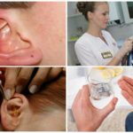 Цялостно лечение на ушни акари